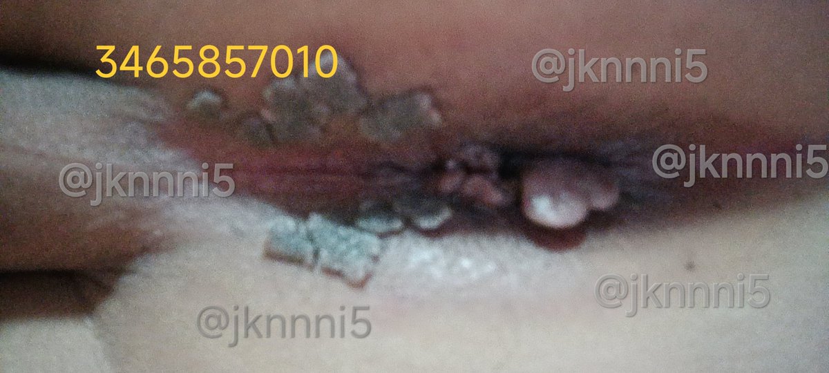 jknnni5's tweet photo. #尖逼#烂逼
什么时候才能找到人🌿我，无套内射，好久没有性生活了，真“饿”。 https://t.co/IJLFW0dlz1