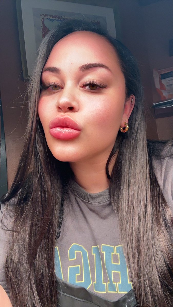 sᴛᴇᴘʜ⋆✿*°ᵕ̈^ tweet media