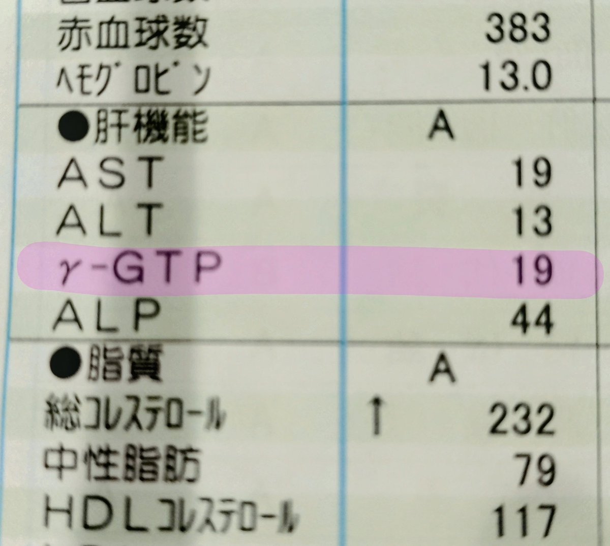 cocopalmamanda's tweet photo. 2026年度健康診断結果。

おかげさまで無事に肝数値が19でしたので、今年度もビールをゴイゴイやらしていただこうと思います。
45歳を超えいつか急に肝数値振り切るんじゃなかろうかと毎年ヒヤヒヤしておりますがまだやれそうです。

中央区千日前1-2-9 ST千日前ビル4階
サカマチネオン20:00〜 https://t.co/PVuryXtSxi