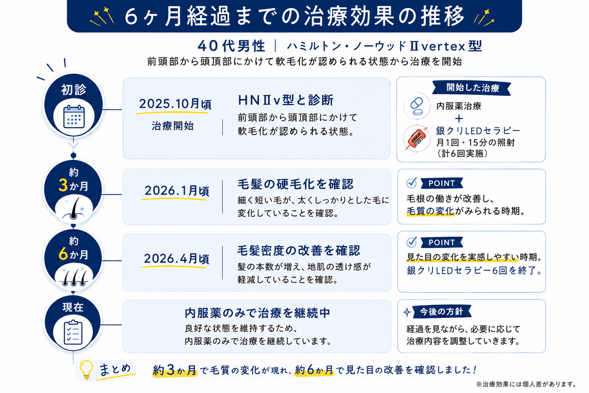 gincli_aga's tweet photo. 【銀クリのAGA相談室 92】
Q.生え際も頭頂部も薄くなっているけど改善できる？

生え際・頭頂部の両方が進行している
場合でも、薄毛の進行状況に応じた治療
によって改善がみられます。

AGAの進行パターンには
・生え際から進行するM型
・頭頂部が薄くなるO型
・前頭部から頭頂部にかけて進行するU型
などがあります。

治療を行う際には経過を写真で
残していきますが、進行部位によって
その見え方は異なりますので撮影の際には
一つの画角だけでなく複数の画角で
撮影し評価することが重要です。

今回ご紹介する40代男性は初診時に
前頭部から頭頂部にかけて
軟毛化が見られ、進行度としては
ハミルトン・ノーウッドⅡvertex型 
と診断されました。

内服薬治療に加え、毛乳頭細胞の活性化を
目的に銀クリLEDセラピーを並行で実施。
LEDセラピーは月に毎月1回・15分の照射を
計6回行いました。

治療開始から約3ヶ月で毛髪の硬毛化が
みられ、LEDセラピーを計6回行った頃には
毛髪密度の改善が認められました。
現在は内服薬のみで治療を継続しています。

今回はこちらの患者様のお写真を
生え際と頭頂部2つの画角から
確認できるよう紹介いたします。
それぞれの部位の変化を
見比べてご覧ください。

※治療効果には個人差があります。

▼「自分に近い症例はある？」
気になる方は、リプライをご覧ください。