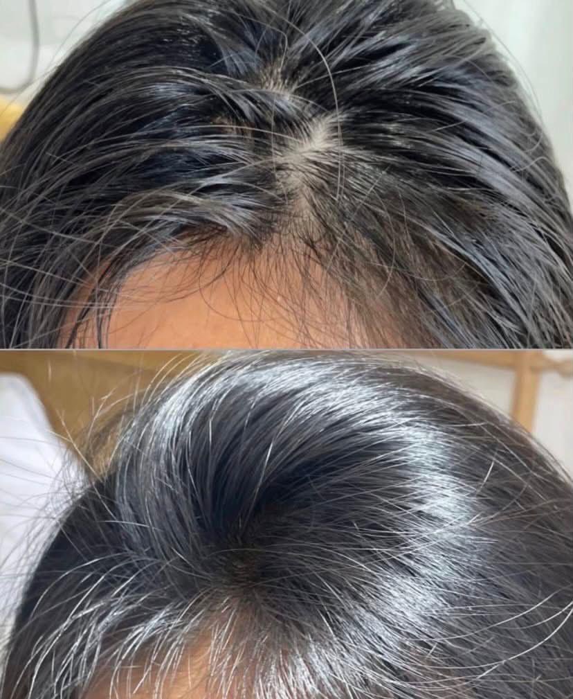 gbbriell1's tweet photo. Sumpah yaa keracunan temen temen yg make.. rambut depan gue beneran jd lebat semenjak ganti pake si peyton ini 😭🙏🏼￼ https://t.co/KzPul4C8zK