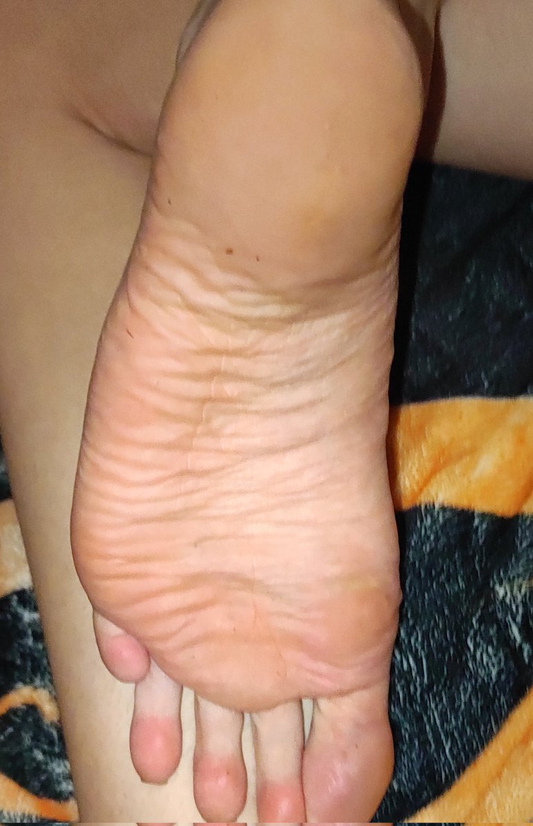 fxxt_queentam's tweet photo. Abend 🔥

Feet toes Slave SUB Footfetish pedi

@ass_andfeet01 @FeetToesSoles @HerSexyFeet @MuseFeetGallery @rt_feet https://t.co/ldWJljkj2h