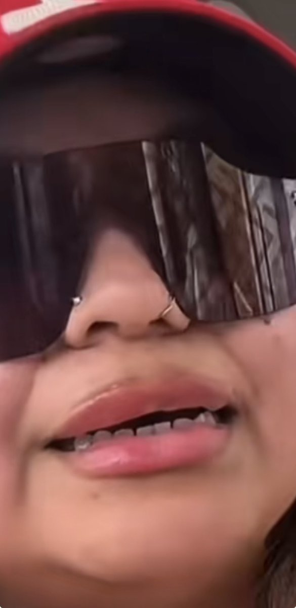 itsqueenbacon's tweet photo. She deadass admitted this on live 😩🤢🤢
That’s why she has tht thing on her lip #ashtrevino #ashleytrevino #trending #bumbump #herpes #wtfisthat https://t.co/z3honFByPM