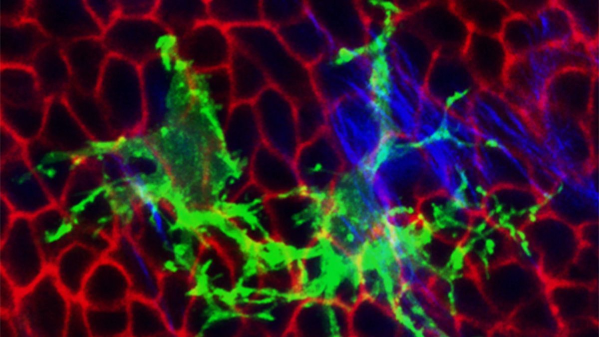 YaleMed's tweet photo. Skin constantly rebuilds itself with the help of #cells called #fibroblasts.
In a study published in @JCellBiol, a team led by YSM's Valentina Greco, PhD, find this regeneration continues even with 60 to 70 percent fewer fibroblasts.
Their findings have major implications for skin #resilience and #aging. Learn more: https://t.co/S3XQtOMQt6