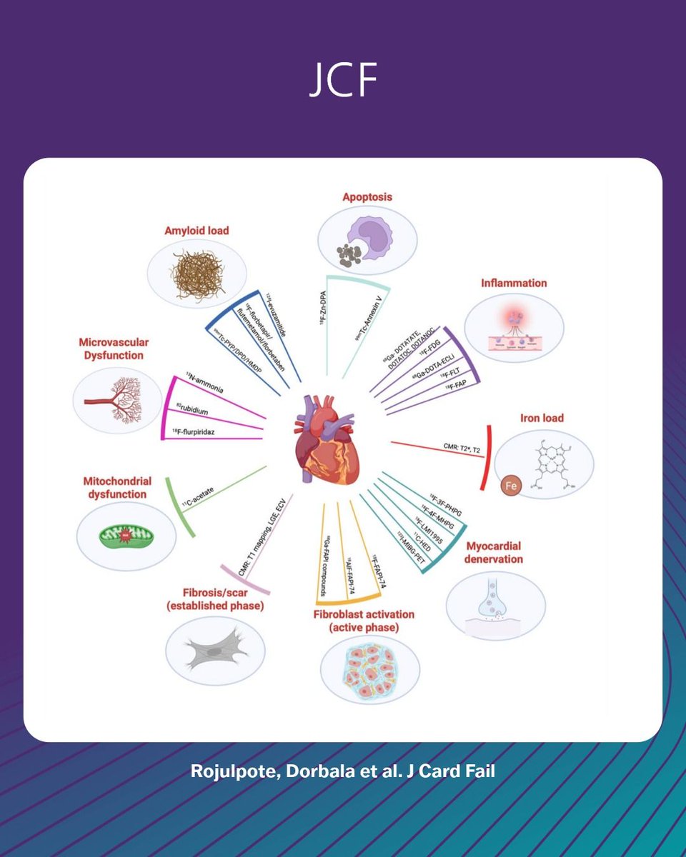 JCardFail's tweet photo. 🫀 Infiltrative &amp; inflammatory cardiomyopathies share common pathways of dysfunction. Advanced imaging is shifting from structure→biology. Probing inflammation, microvascular dysfunction, and energetics to refine diagnosis and guide precision HF care. 

https://t.co/B47XDcT9p2 https://t.co/ysiyCzQTgJ