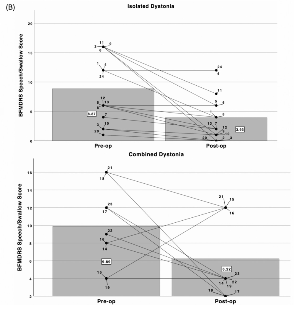 MDJ_Journal's tweet photo. Patients with isolated dystonia, but not those with combined, showed measurable improvement in speech/swallowing after DBS treatment, per a retrospective cohort study supported by @movedisorder Voice, Speech, and Swallowing Movement Disorders Study Group. https://t.co/PsJUq0QxMw https://t.co/ChmojYQYGo