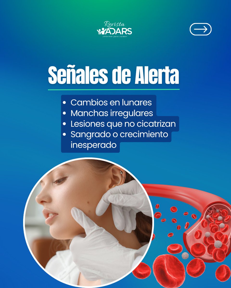 ADARS_RD's tweet photo. La detección temprana de 'Tumores Malignos en la Piel' salva vidas. 🩺
El daño solar se acumula con los años.
➡️Profundiza en este tema con el artículo completo en Revista ADARS ¡Informar para cuidar!
🔗https://t.co/UymgujdLX3
#ADARS #SaludDigestiva https://t.co/2Xn4riRiPi