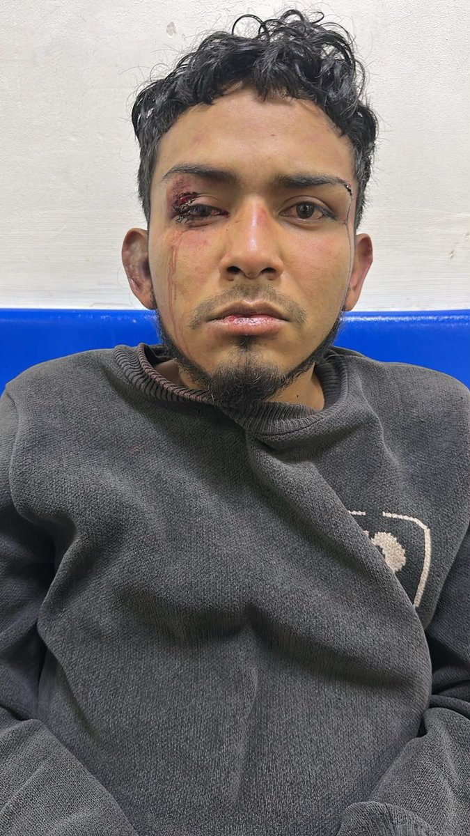 horusperegrinus's tweet photo. #Horus 🦅 En el barrio Gustavo Restrepo de Bogotá, un ladrón fue atrapado por la comunidad tras intentar robar una motocicleta frente a un local comercial. Sus cómplices lograron escapar, pero el sujeto recibió paloterapia de los vecinos. #NoMasRatas #Horus https://t.co/UBrYuF7liL
