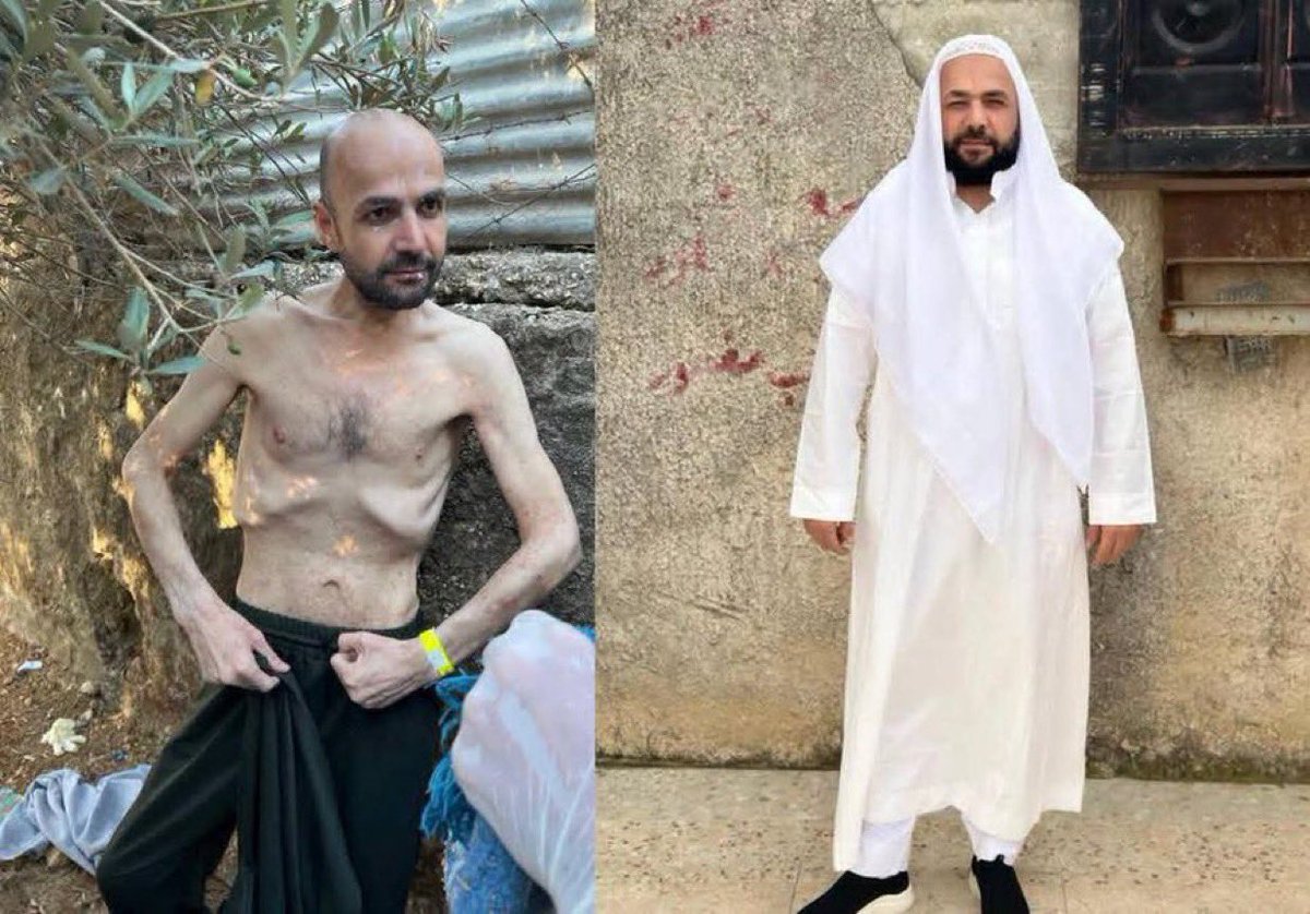 DropSiteNews's tweet photo. Palestinian prisoner Ayman al-Fakhouri has been released from Israeli prison today after 26 months behind bars without charge or trial, Quds News reported, sharing before-and-after images showing his severe physical deterioration in detention.

Israel’s widespread use of administrative detention allows Palestinians to be held indefinitely on secret evidence for renewable periods, without being told the accusations against them or facing trial. Palestinian and Israeli human rights groups, along with released detainees, have documented systematic torture, rape, starvation, beatings, and medical neglect across Israeli prisons since October 2023, conditions that have left many prisoners emaciated and that have killed scores in custody. 

Al-Fakhouri’s gaunt appearance on release echoes that of other freed detainees, including journalist Ali al-Samoudi, who reportedly lost some 60 kilograms during his imprisonment.