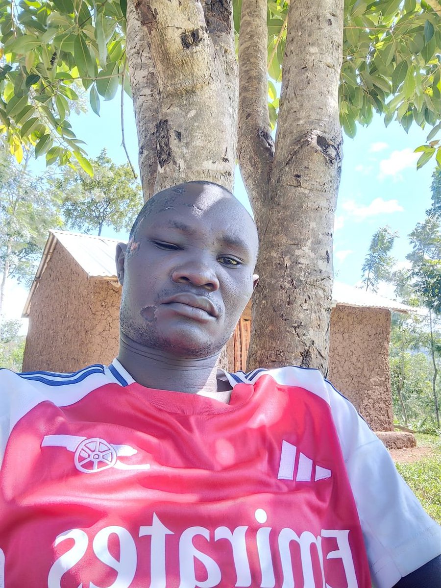 AbalaWilliam's tweet photo. 🚨Dickson Odhiambo’s Appeal: Help Needed For Head Injury Treatment
Many Gor Mahia fans know Dickson Odhiambo- the familiar face who sells jerseys and club merchandise outside stadiums, always supporting the game he loves.
Dickson suffered serious injuries during post-match chaos in Homa Bay after the @OfficialGMFC vs @MaraSugarfc match. He sustained severe head injuries and is now facing costly treatment, medication and therapy.
He is appealing to well-wishers, fans and the football community for support during this difficult period.
Any assistance can help.
📞 Support Dickson through: 0712499435
Football is about community. Let’s stand with one of our own. ⚽
#SportsRadar #supportlocal #kenyanfootball