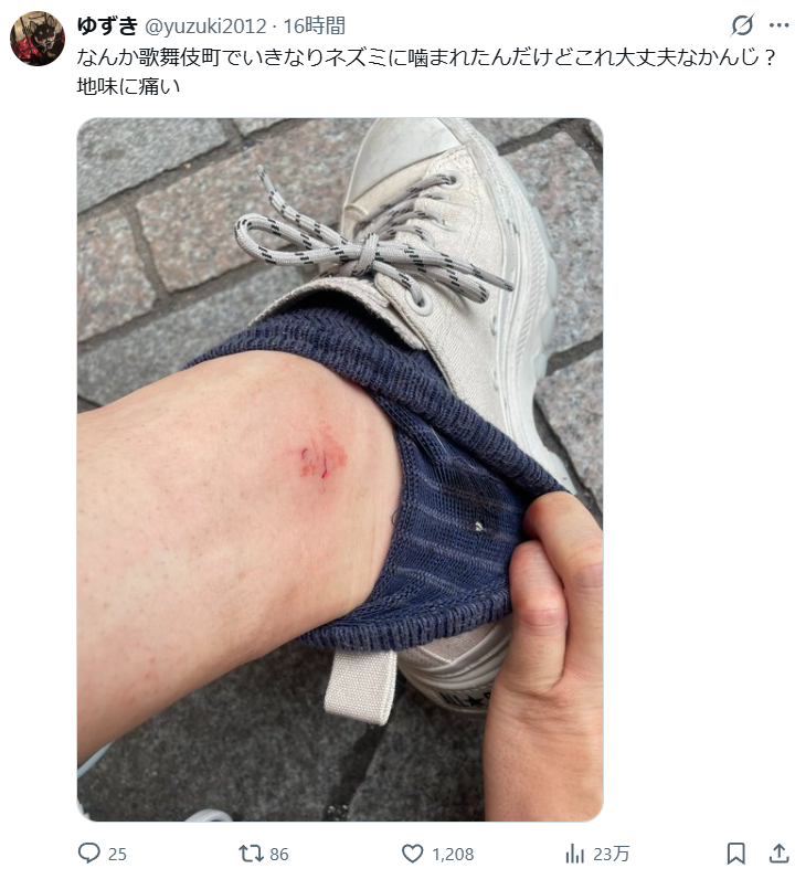 gesgest121's tweet photo. 【恐怖】歌舞伎町でネズミに噛まれる
↓
１０分ほどで顔がはれ始める
↓
ワクチンがなく病院たらいまわし
↓
仕事を休むとポストをして12時間音信不通←イマココ
#バイオハザード #新宿 https://t.co/twmtZ8tpTa