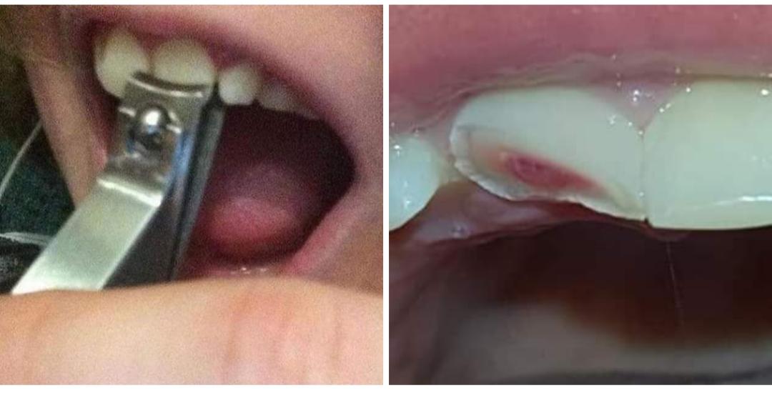 raphlsnts's tweet photo. @lobotosasha Se nossos dentes fossem um só não seria tão fácil pra aparar quando cresce demais https://t.co/Hlap0nWthl