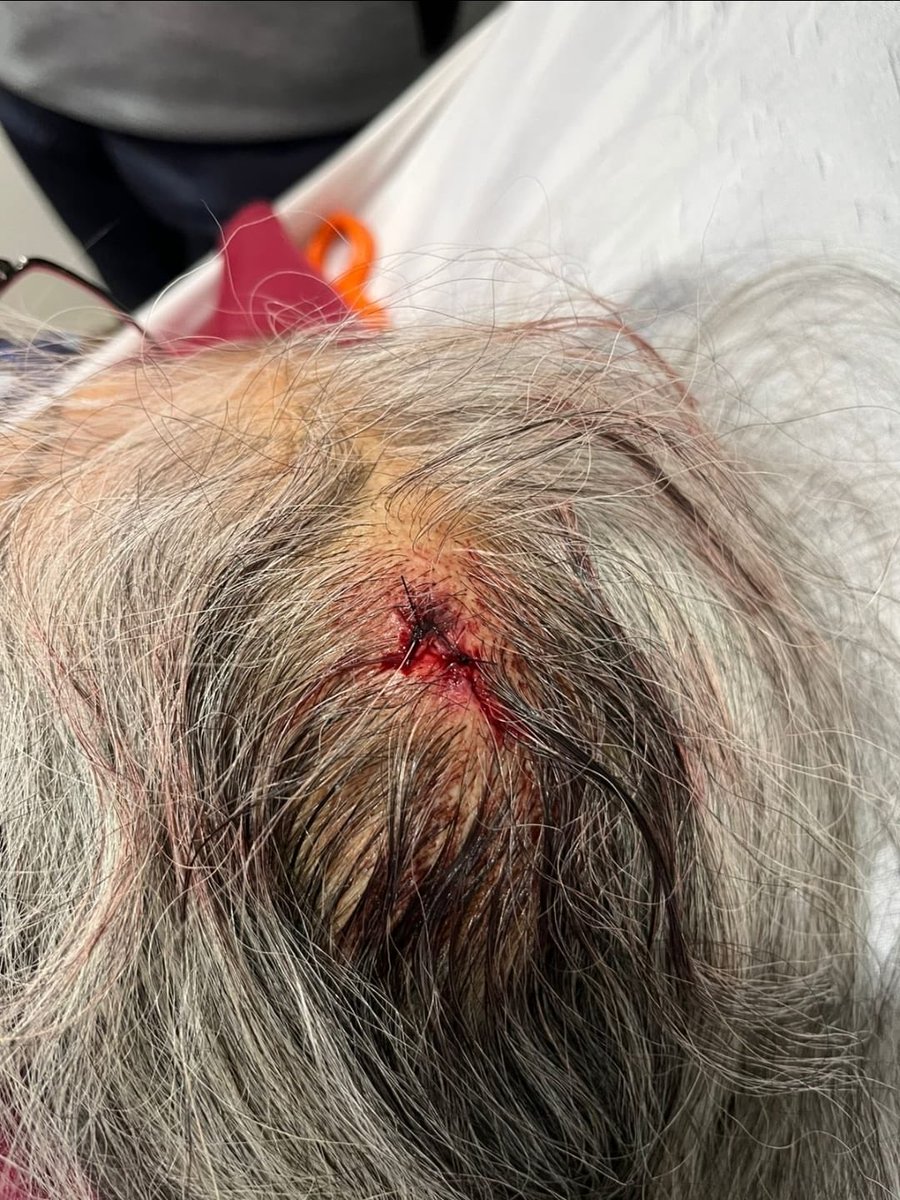 roberto_toga's tweet photo. En el albergue del DIF “Casa Amor”, en @Ecatepec , existen actos de maltrato e indignación que no pueden seguir siendo ignorados. ¿Hasta cuándo se va a permitir esta situación? @CNDH #Ecatepec #EdoMéx https://t.co/yY2qJZs9Tn