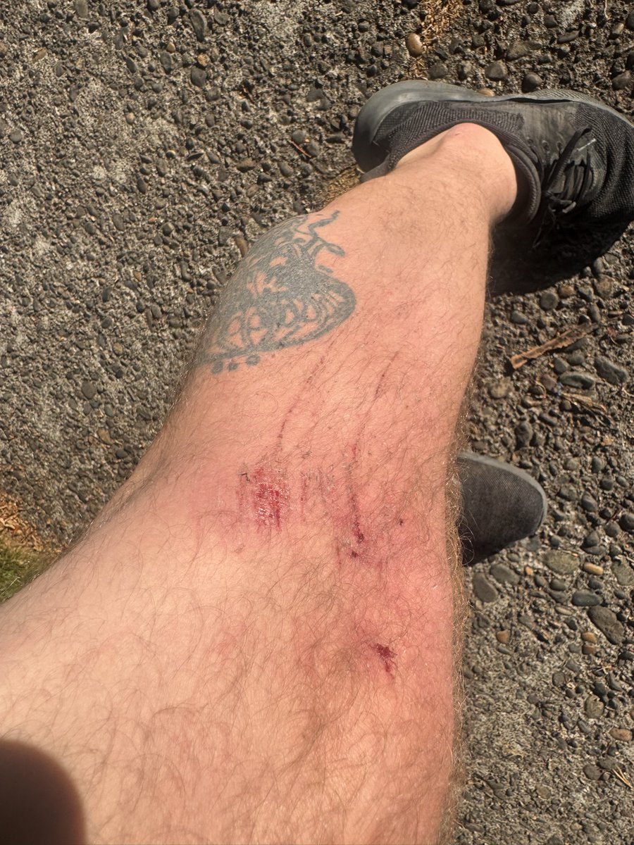 Midnightballoon's tweet photo. don’t recommend wiping out on a lime scooter going downhill https://t.co/Eee7lCohVe