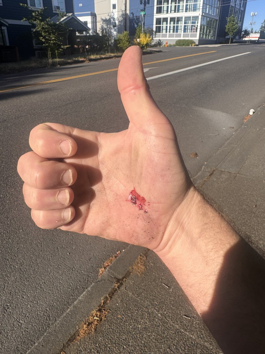 Midnightballoon's tweet photo. don’t recommend wiping out on a lime scooter going downhill https://t.co/Eee7lCohVe