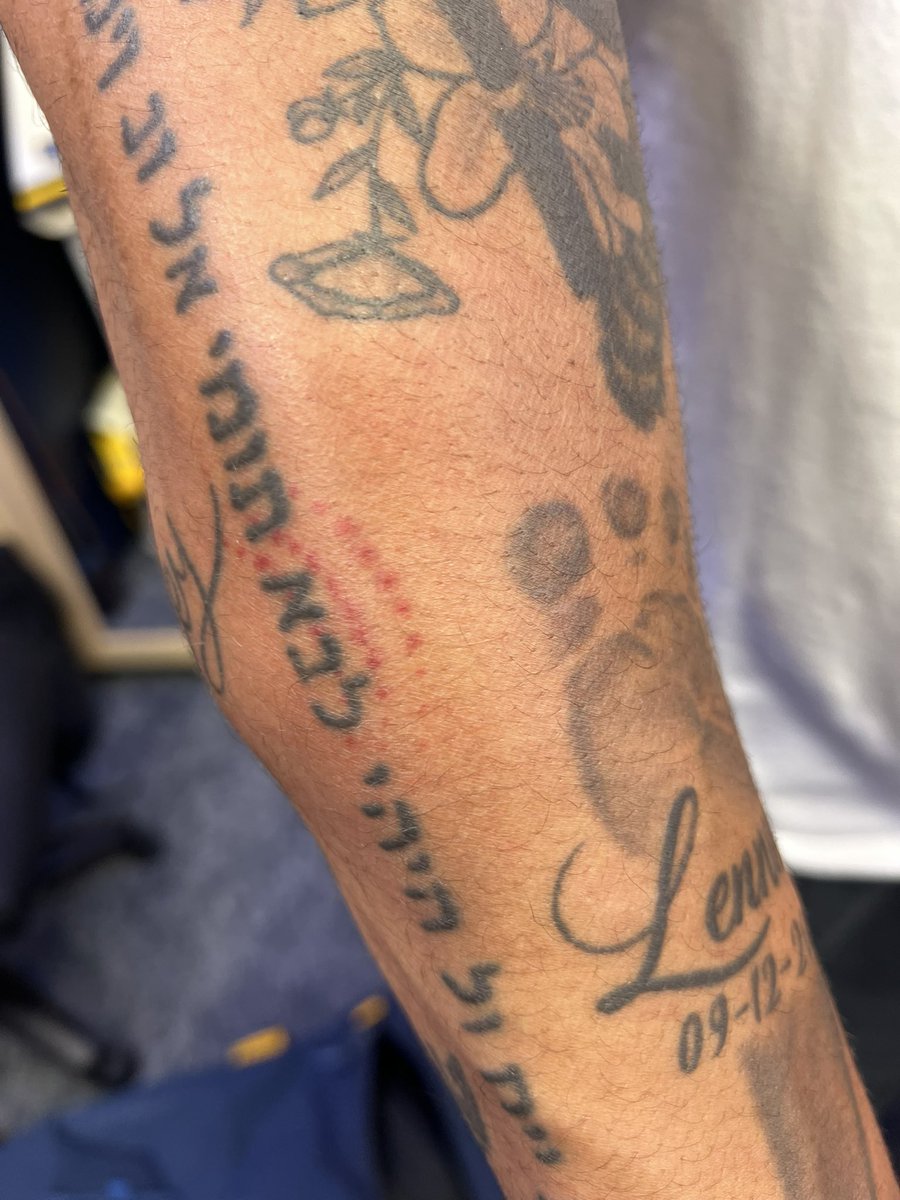 Patman402's tweet photo. @KatieKatieHH  @softtosslefty @Chris_Davenport   Brewer pitcher Grant Anderson got hit by a batted ball today you can see the seams! Ouch. Knocked him out of the game. https://t.co/CSk9B4DnqF