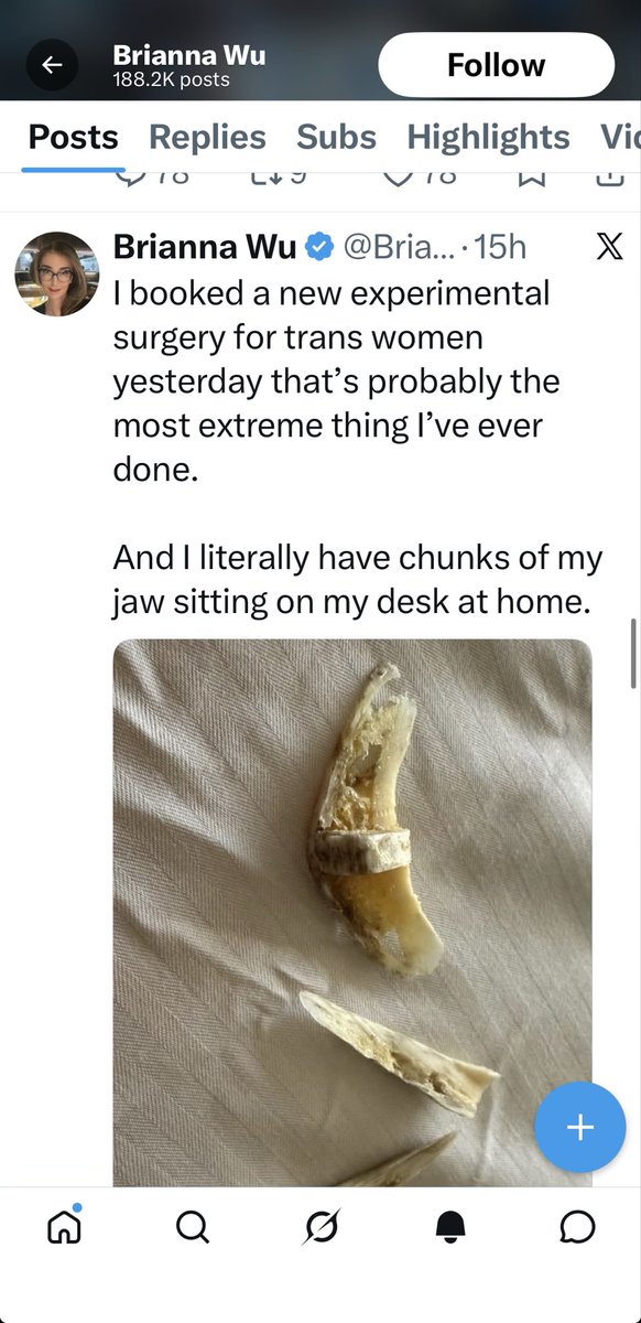 XxtraEstroGenny's tweet photo. “TRANS” is 100% mental illness. https://t.co/eX3uPg0sB0