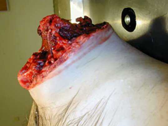 swediishpsycho's tweet photo. #goretwt 

car accident ... ouchie https://t.co/oaHh6Oba8w
