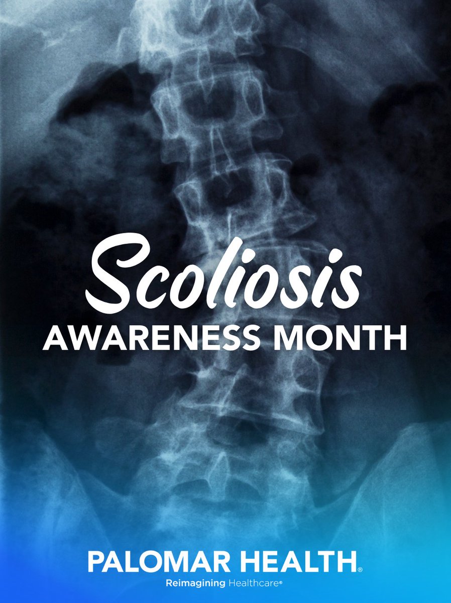 PalomarUCSDH's tweet photo. Have you or a loved one been affected by scoliosis? Share your experience below. ❤️‍🩹💬

Learn more about orthopedic and spine care at Palomar Health:
https://t.co/lJ7f08wRmv

#SanDiegoHealth #EscondidoCA #OthopedicCare #SpineCare https://t.co/WiC3JduhcS