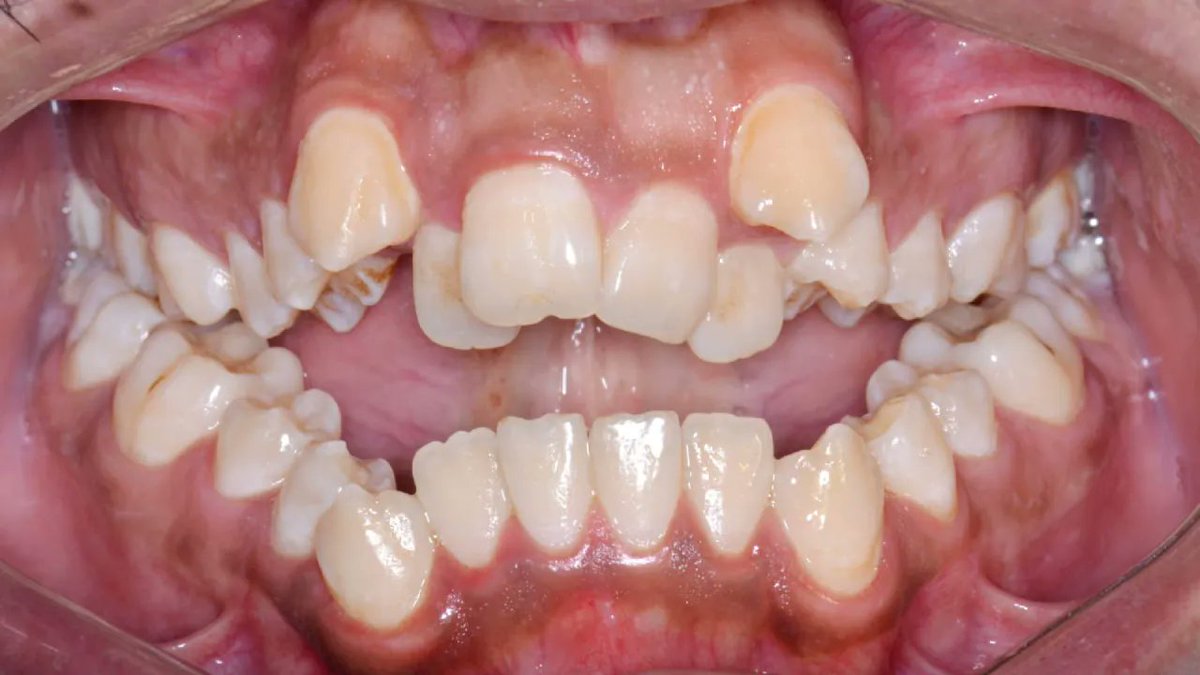 620ckrm's tweet photo. It is a necessary evil....Something we all have to do and yet it is very hard to find anyone who likes doing it. I’m talking about going to the dentist.
https://t.co/MBy0bPuVoo
-Colin #Harvardmediaeverywhere #GoHarvard https://t.co/418E1oCpkz https://t.co/69sddYqOTA