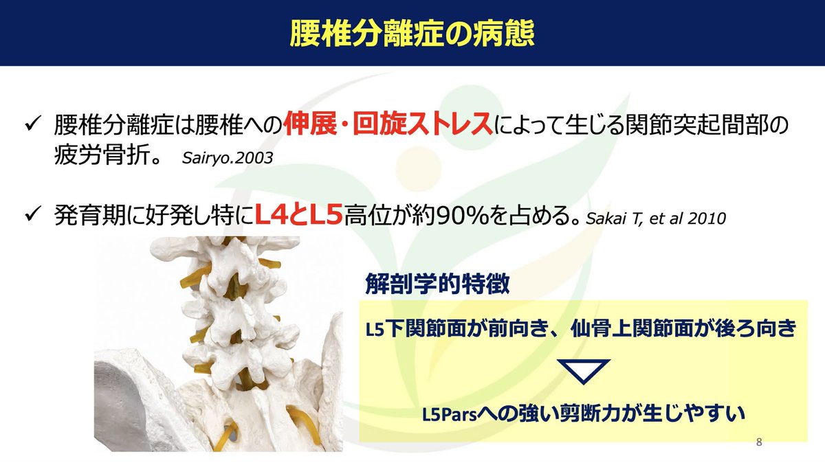 Spo_Lab's tweet photo. 瞬発的な動作は腹横筋の先行収縮が生じている。

腰椎分離症のリハビリテーション
運動療法×体外衝撃波の治療戦略
講師：つくばウェルネス整形外科　山口真吾
日時：2026.6.14 21:00〜オンライン開催
https://t.co/X7mbYl3DTK https://t.co/zGIE12BmYi