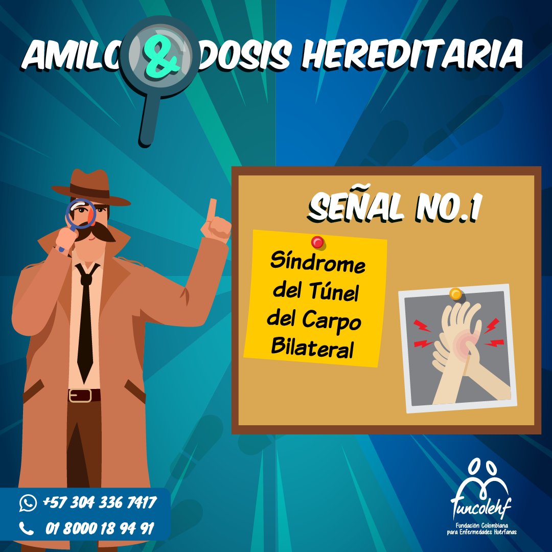 AmiloidosisCol's tweet photo. Los detectives Amilo &amp; Dosis encuentran una pista: síndrome del túnel del carpo en ambas manos. 
Aunque puede asociarse a movimientos repetitivos, cuando afecta las dos manos es importante consultar y considerar otras causas, como la #AmiloidosisHereditaria. 
💚
#FUNCOLEHF https://t.co/jXqkFEqyUs