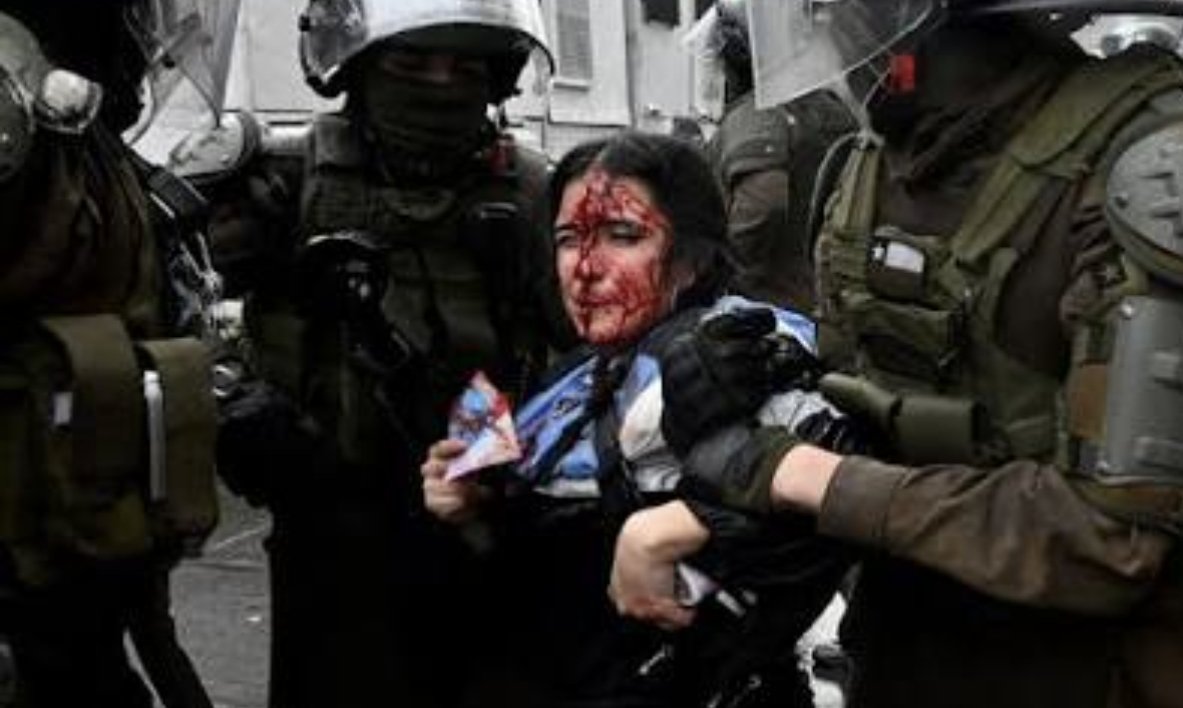 ALERTADESISMO's tweet photo. Vuelco: Mujer arrastrada por Carabineros le llegó una piedra de los mismos compañeros de la causa https://t.co/f3qd3btSso https://t.co/PsRUFX303Q