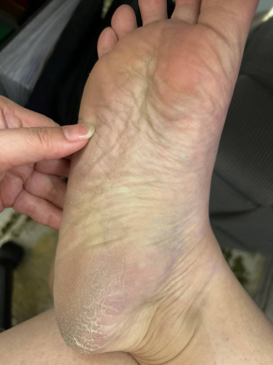 EeKloi's tweet photo. Any ladies who love feet getting lick and suck during massage feet.

#footfetish https://t.co/XFVBDsZisz