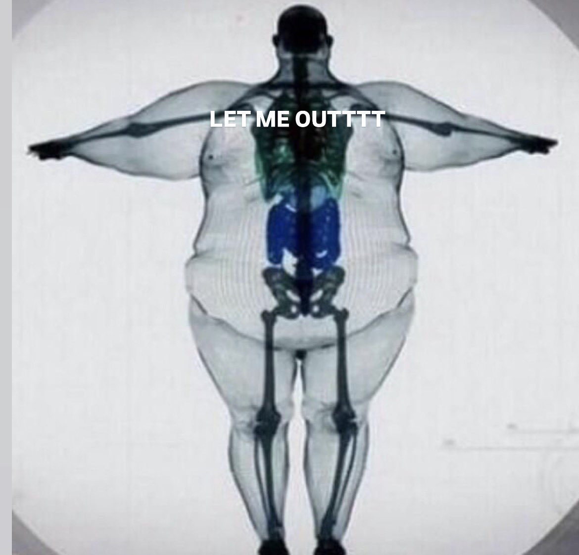 melting_ramskul's tweet photo. My skeleton just wants out 
Free my boy https://t.co/XckRbMWS3s