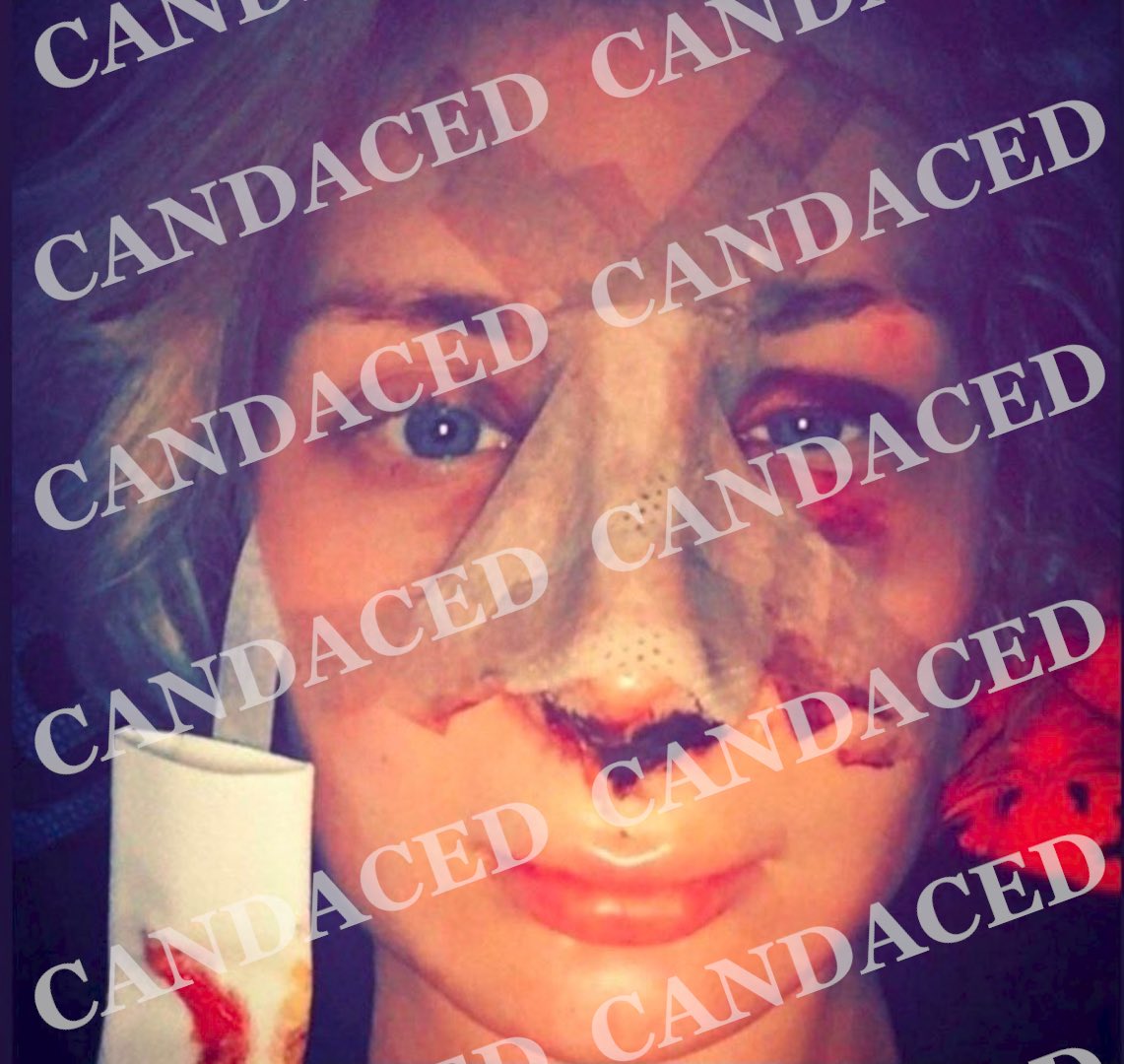 LibtardsHateMe's tweet photo. @ED_HARDEE @LauraLoomer The wild part is she already had the nose but got surgery to make it look more European and less jewy 🤣 https://t.co/vOH575t0c1