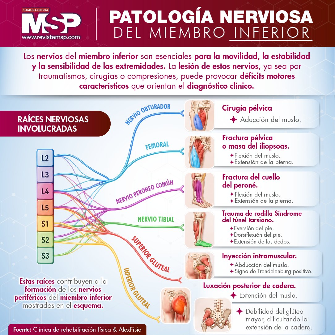 RevistaMSP's tweet photo. #MSPNeurología 🦵 Los nervios del miembro inferior hacen posible el movimiento y la sensibilidad de las piernas. Lesiones por traumatismos, cirugías o compresiones pueden afectar la marcha y la movilidad. Conoce más en esta infografía. ¡Comparte! #SomosCiencia #LiderDigital https://t.co/27ikQP3h9p