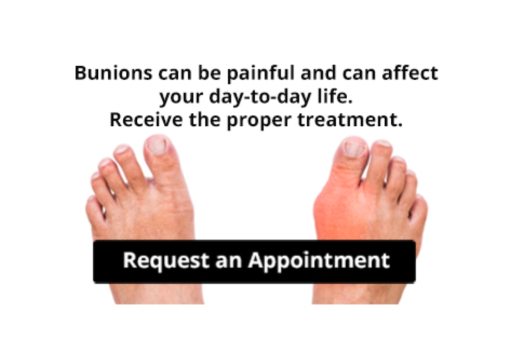DrAlanSpector's tweet photo. Are Bunions Affecting Your Everyday Life? https://t.co/Vmv2YxDegB https://t.co/NYCNgmb1u0