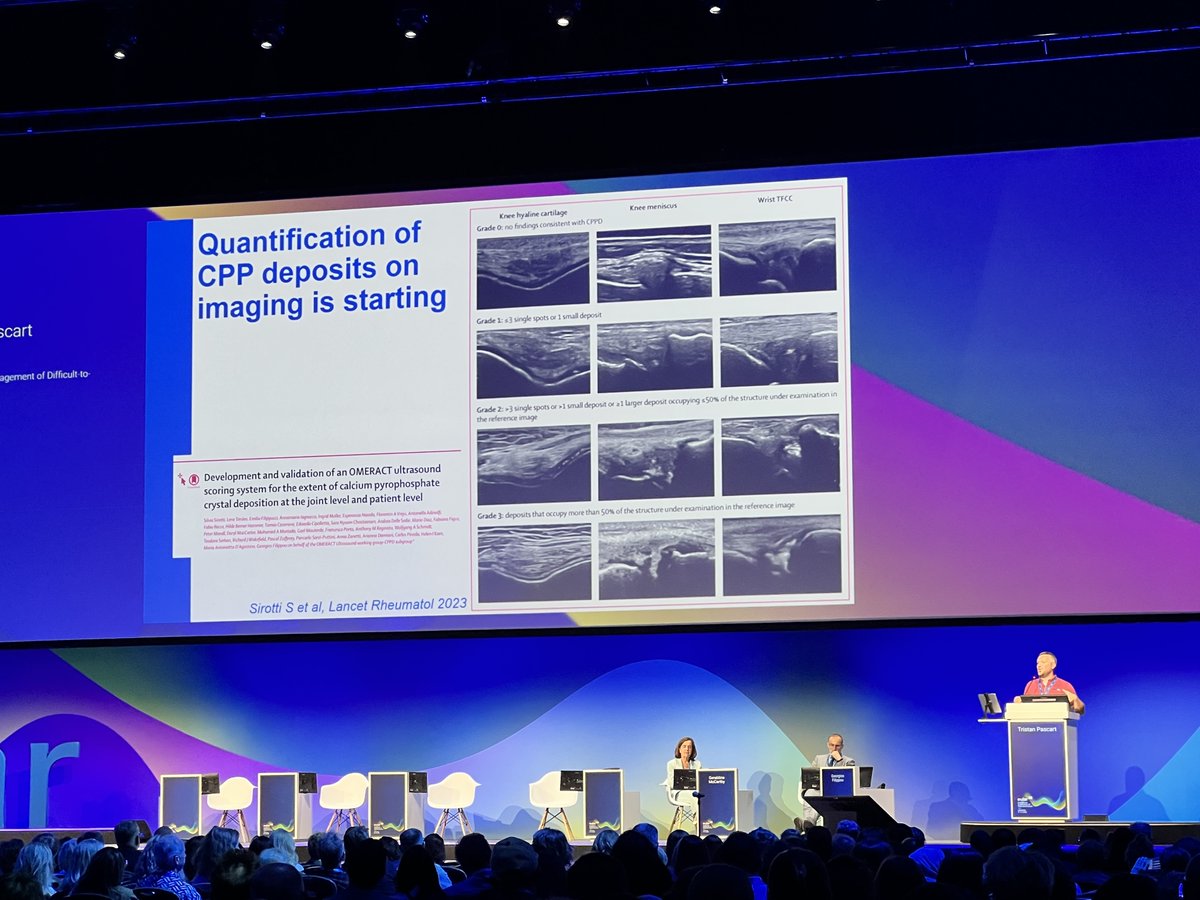 eular_ero's tweet photo. #EULAR2026 highlights in #CPPD imaging:
🔹 US quantification is becoming feasible with emerging OMERACT-based scoring systems.
🔹 AI-driven detection on XR, US, and DECT is moving from concept to reality.
🔹 Shifting from simple detection toward quantification of crystal burden. https://t.co/xKvU9jz4dk