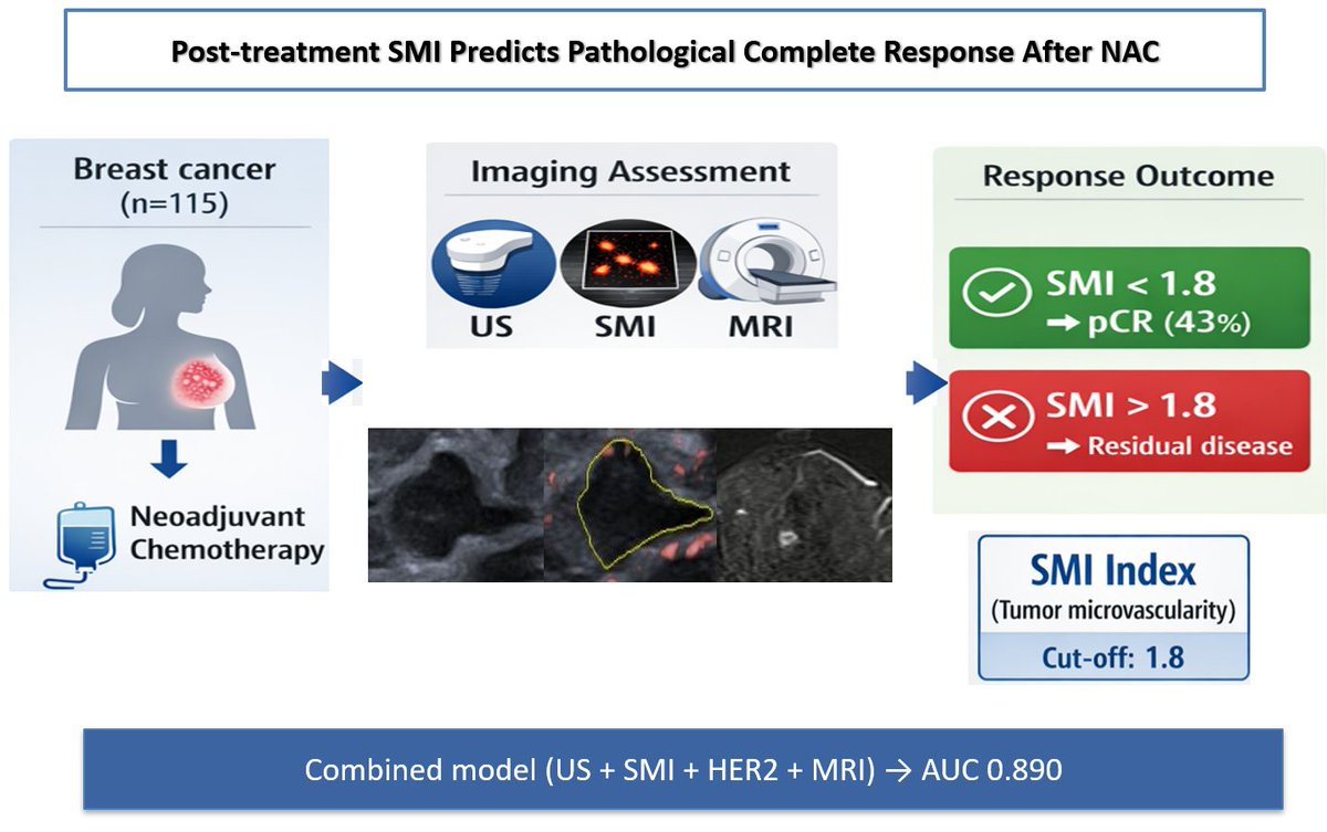 Bioeng_MDPI's tweet photo. 🎗️ SMI index below 1.8 predicts breast cancer pCR with AUC 0.804, rising to 0.890 when combined with MRI and HER-2 status. 

👉 https://t.co/xPBUVNdHeX

#BreastCancer #NeoadjuvantChemotherapy #PrecisionMedicine https://t.co/d0blgtlst1