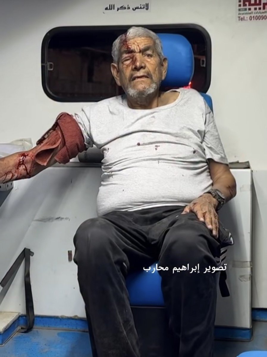 MosabAbuToha's tweet photo. Fuck this israeli terrorism that continues to slaughter children and the elderly.
This grandfather was wounded in the middle of his sleep in a tent.
Do you know when israel carried its savage strike on the tent in Khan Younis?
It was 04:07 a.m.

Fuck this terrorism and savagery https://t.co/0tmyRz3Njq