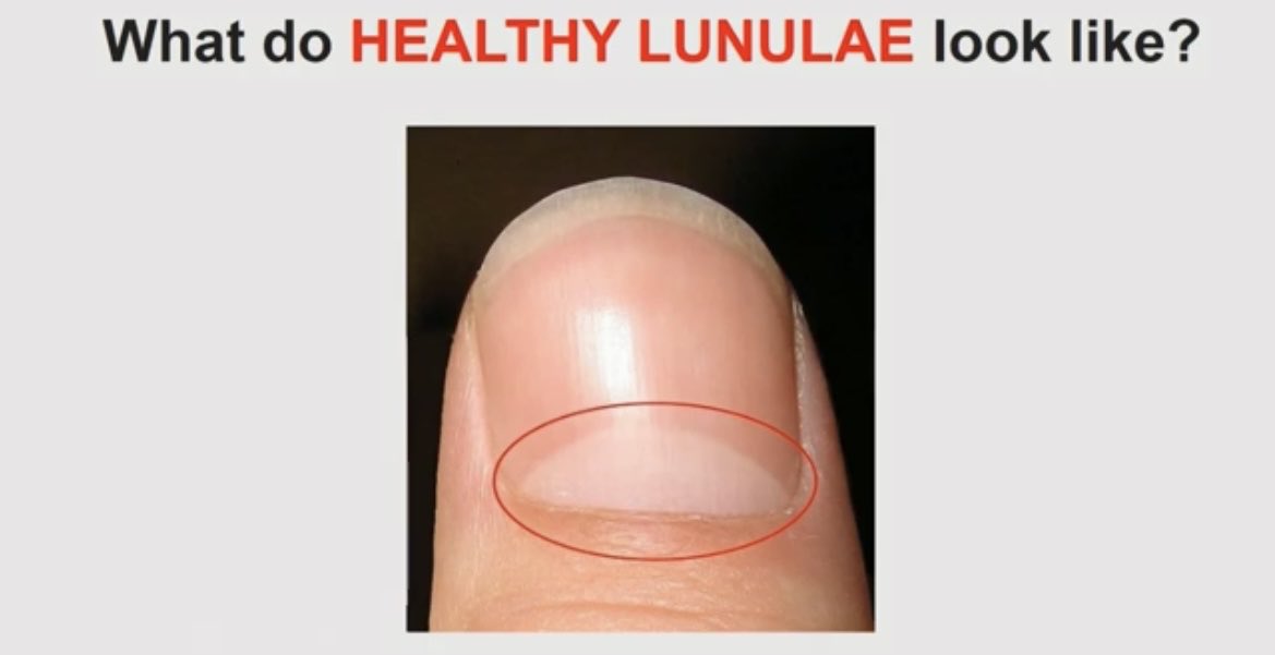 DaleFinkJr1's tweet photo. It was in the urine. I’ve been to his Institute in Houston. I’ve met the man. 
I hope this is new information from you because he cured cancer a long time ago and every agency under the sun came after him guns of blazing
Do you know who this is? It’s one of the reasons I study ancient Hindu medicine I swear it took me at least a month to correctly say his name.