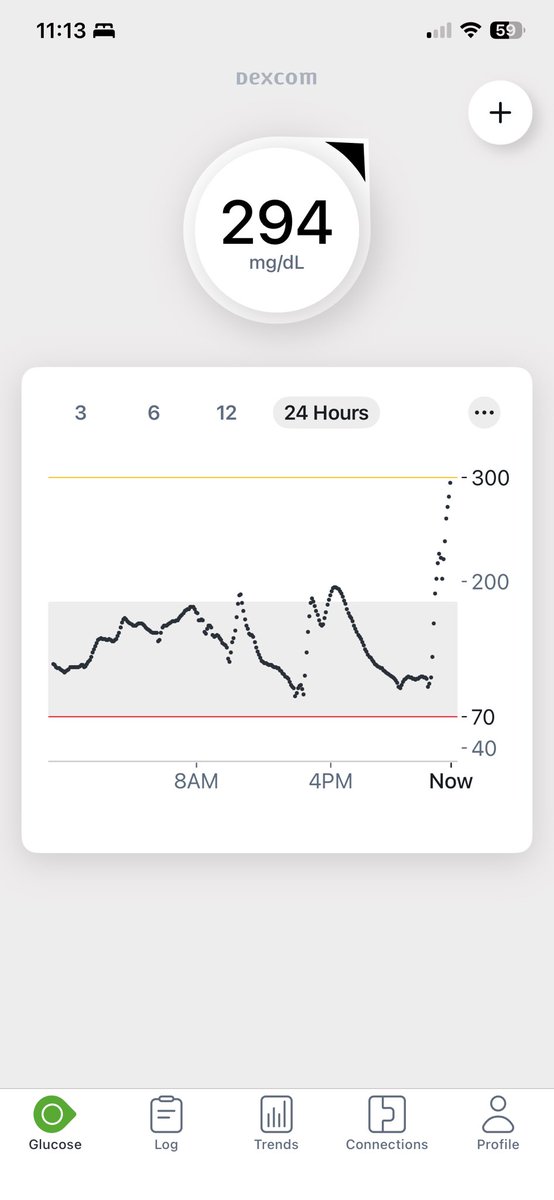 ClassyKellyAtl's tweet photo. What is @ChickfilA doing to their food to make my blood sugar spike THIS high nearly 2 hours after eating from there??? A healthy choice lead to this! https://t.co/AKQWTv1sVO