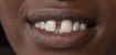 robfri's tweet photo. @canarymission Baby fell through two skanky front teeth. https://t.co/CTIuG40PDe