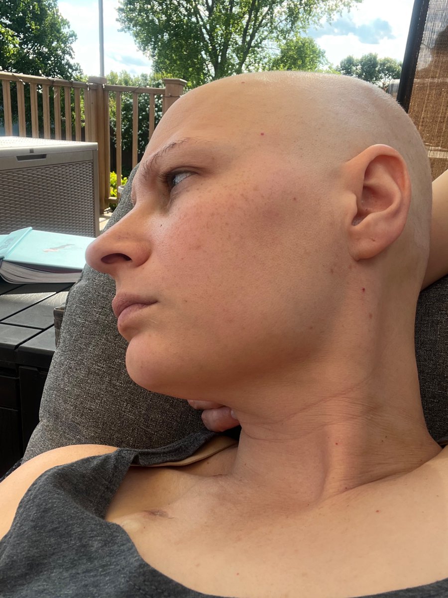 Meuesa05's tweet photo. One week

One week left with breasts
One week before restrictions
One week to do it all

Today I…
✅Had my teeth cleaned
✅Got 4 lessons done
✅Got cleared for surgery
✅Familiarized myself with my mastectomy supplies

One week

#breastcancer https://t.co/z1qxNOuoMO