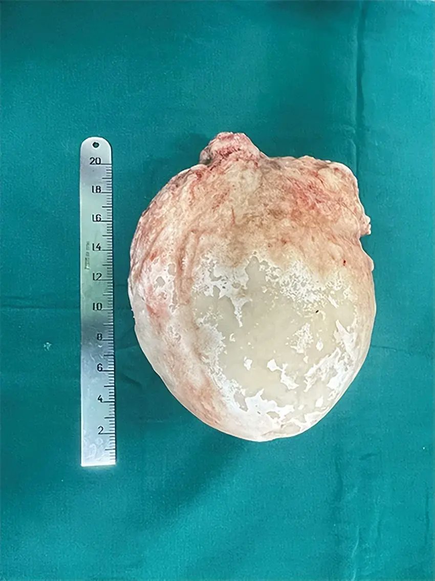 headnecksurgeons tweet media