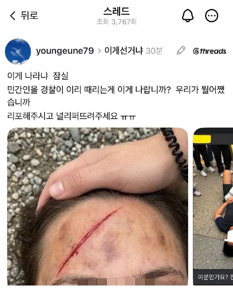 Truthmind2's tweet photo. 잠실에서 부상당한 시민 이마 상태.

민간이을 이렇게 큰 상처가 나게

폭행하는 것이 정녕 맞나요?

스레드 펌. https://t.co/iyjiLyVjIl