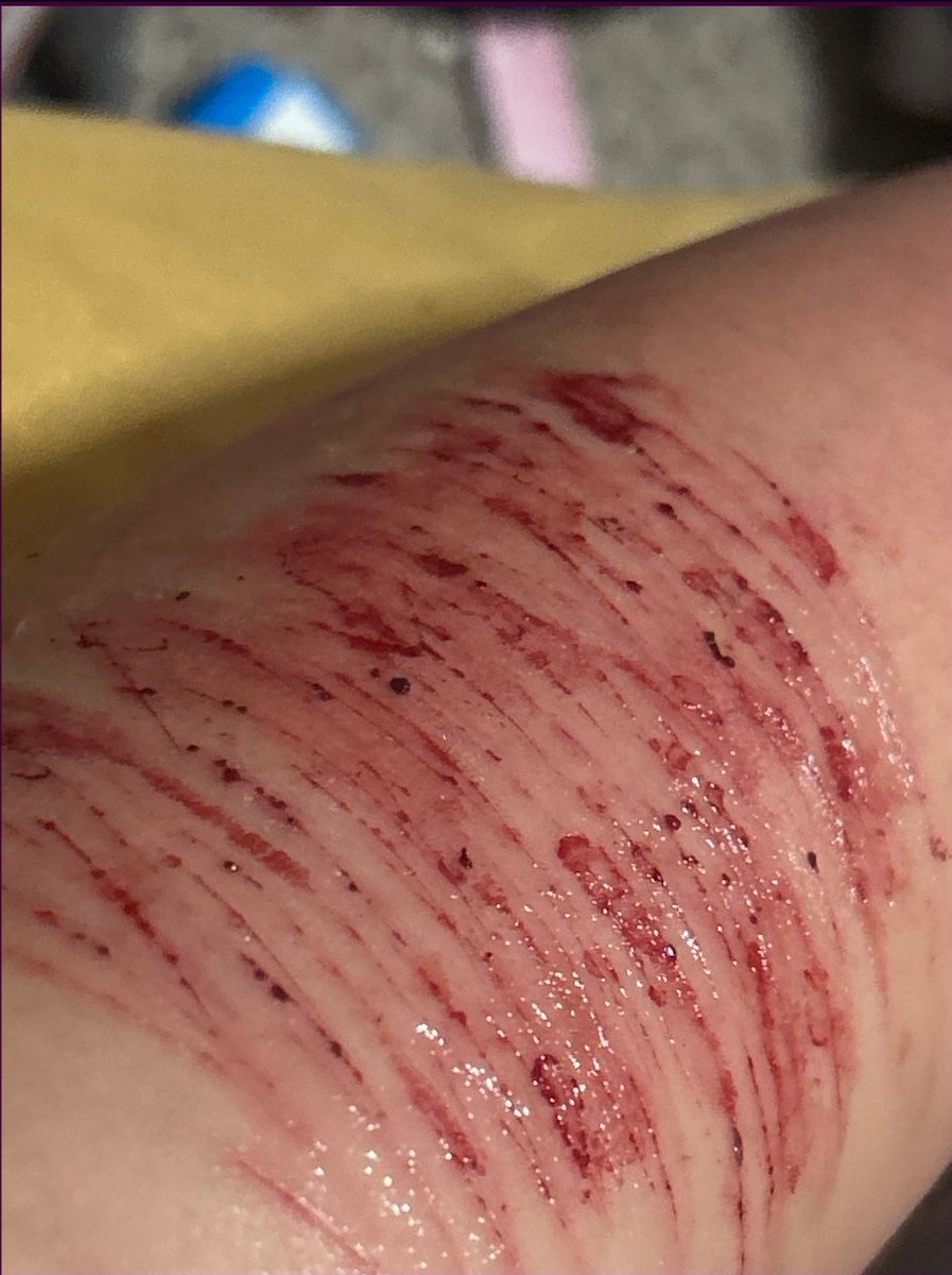 XanaphiaNailo's tweet photo. Shower cuts are the best bc the blood runs so much better. Anyways life is great rn don’t forget aftercare!!! 

(ALL SFX MAKEUP NOT REAL) 

<3333 love ya have a great day 

#shedtwt #slittwt https://t.co/VmjU47D6gy