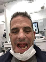 Tim650i's tweet photo. @michelle_8972 @RealRayDonE There is no “best thing” about Hunter. 

It’s ALL bad:

Tax cheat
Lied under oath 
Crackhead and alcoholic 
Abandoned his daughter 
Slept with his dead brothers wife and got her addicted to crack.
He’s simply a HORRIBLE human being.

But he always gave 10% to the big guy💯🤣🖕🏽 https://t.co/cCXXWPQl65