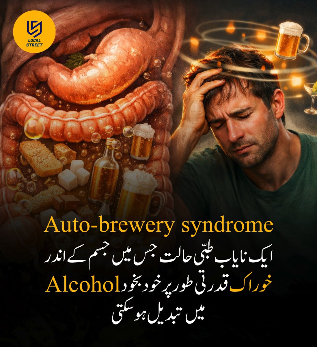 LocalStret's tweet photo. Auto-brewery syndrome ایک نایاب طبی حالت ہے جس میں آنتوں کے اندر موجود مائیکرو آرگینزمز کاربوہائیڈریٹس کو الکحل میں تبدیل کر دیتے ہیں جس کے نتیجے میں مریض میں نشے جیسی علامات جیسے لڑکھڑاہٹ، ذہنی دھند اور الکحل جیسی بو ظاہر ہو سکتی ہے

Eric Poulin کی کہانی اس حالت کی ایک مثال کے طور پر سامنے آئی ہے جنہوں نے کئی سال تک بغیر الکحل استعمال کیے ایسی علامات کا سامنا کیا بعد میں انہیں اس نایاب بیماری کی تشخیص ہوئی اس صورتحال نے ان کی روزمرہ زندگی اور کام کرنے کی صلاحیت کو متاثر کیا

آج وہ اپنی اہلیہ Sarah کے ساتھ مل کر اس بیماری کے بارے میں آگاہی بڑھانے اور مریضوں کی مدد کے لیے Abstrack نامی ایک ایپ پر کام کر رہے ہیں

نوٹ: یہ پوسٹ صرف معلوماتی مقصد کے لیے ہے اور مختلف عوامی رپورٹس پر مبنی ہے اس میں دی گئی معلومات طبی مشورہ نہیں ہیں ایسی علامات کی صورت میں ہمیشہ مستند ڈاکٹر سے رجوع کریں

#RareDisease #HealthAwareness #AutoBrewerySyndrome #MedicalFacts #BrainHealth