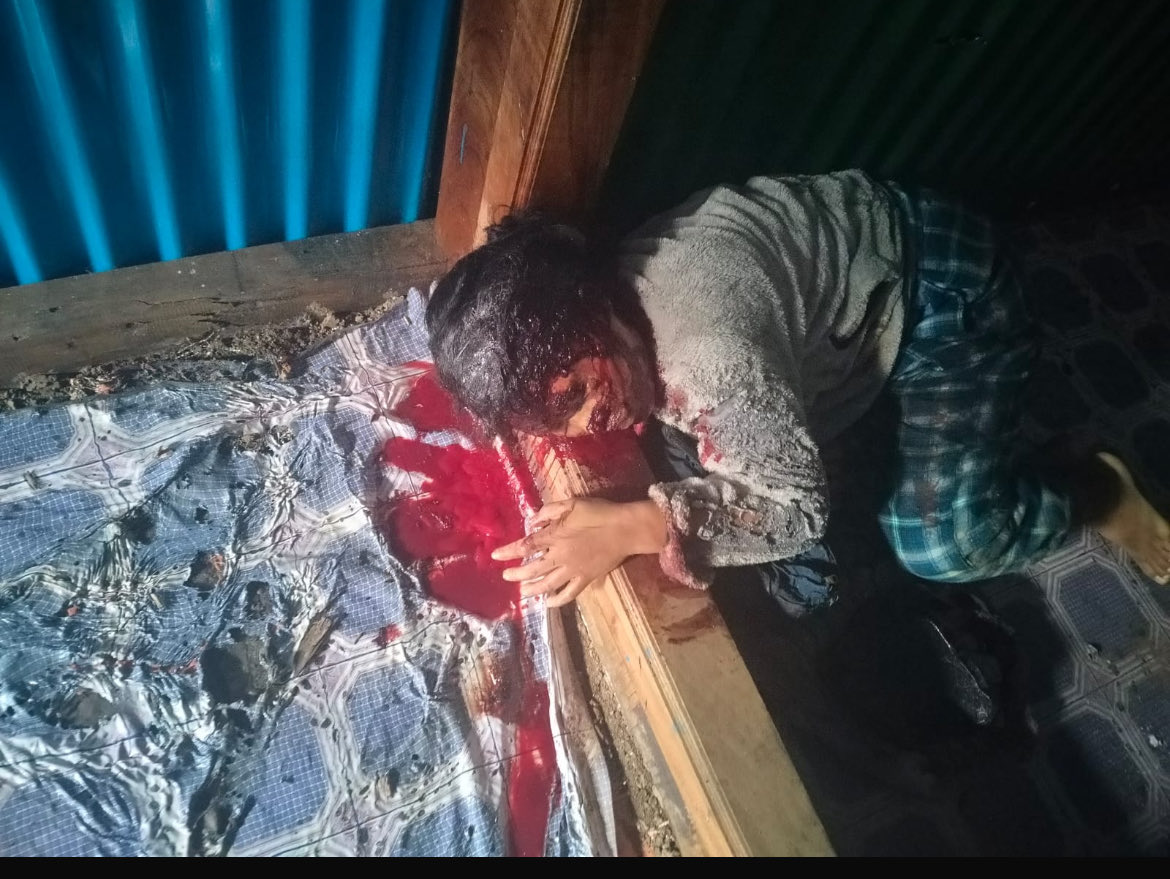Khulkonns_3382's tweet photo. @power_corridors ZUF and NSCN IM killing women and helpless women…
What a shameful act..
May the old mother rest in peace https://t.co/jIrHAFyAZk