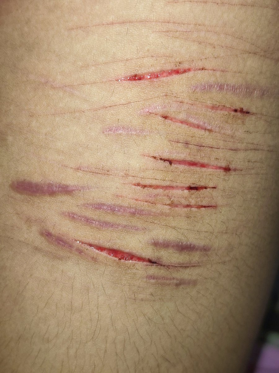 jane_luvssh4's tweet photo. Yumz all sfx makeup #shtwt #SelfHarm #slittwt https://t.co/eO2APZiNly