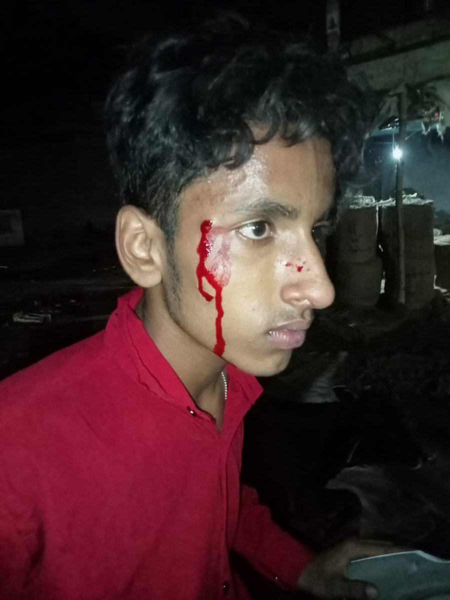 Pulkit_tr's tweet photo. #कानपुर के नौबस्ता थाना से कुछ दूरी पर #दबंगों ने #नाबालिक लड़के को जमकर पीटा, 3 दिन बीत जाने के बाद भी पुलिस ने अभी तक कोई #FIR दर्ज नहीं की है, न ही घायल का मेडिकल कराया है, ऐसे में दबंगों के हौसले बुलंद नहीं होंगे तो क्या होगा। @Uppolice @kanpurnagarpol @dgpup @CMOfficeUP https://t.co/9QKu7ekIlA