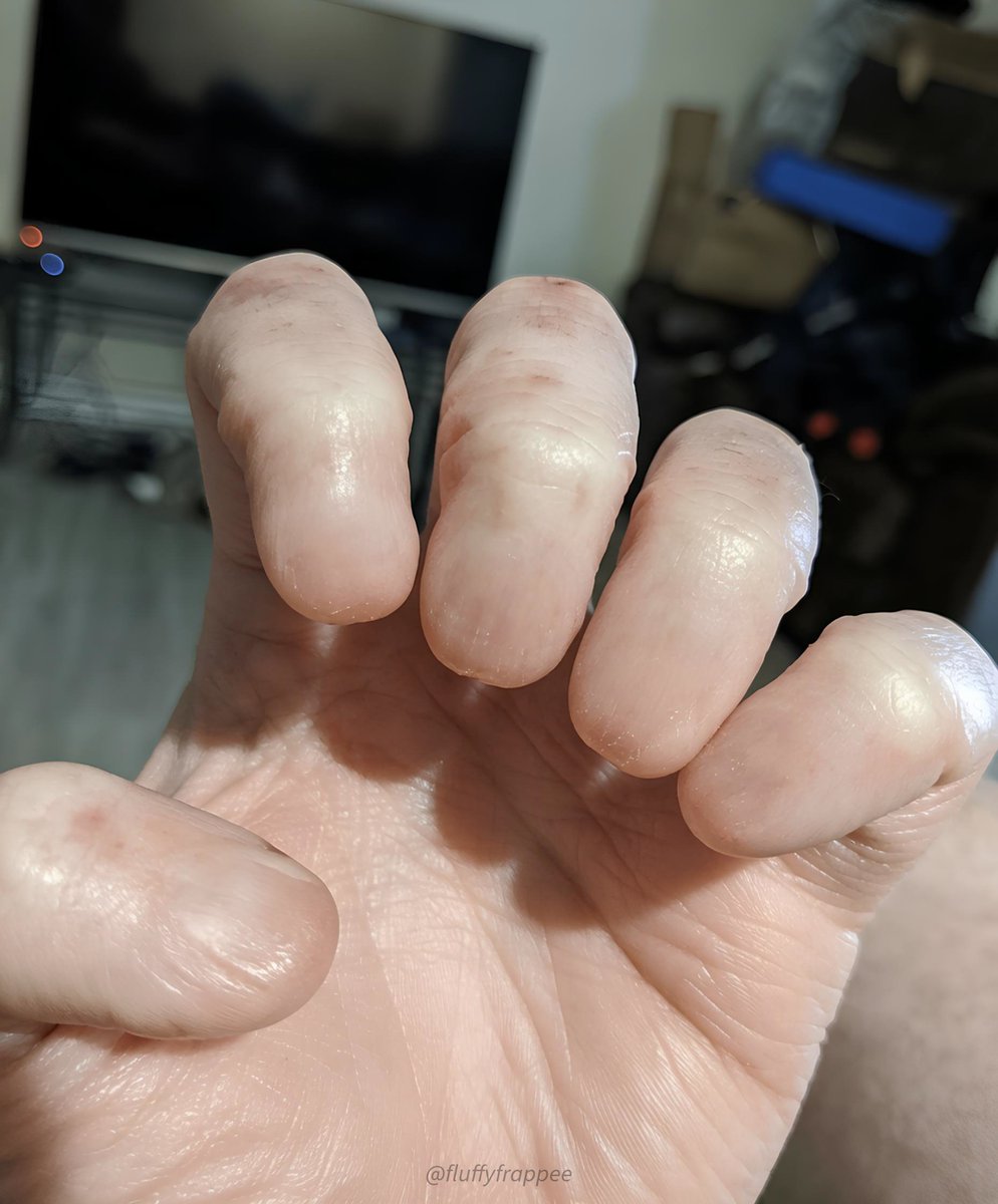 fluffyfrappee's tweet photo. Hey @grok why do we have nails on fingertips when we could've had smooth fingers like this? https://t.co/htnbFYAgDy