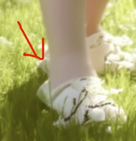 becmarters's tweet photo. @ViQueenie The foot?? https://t.co/9Tsj4p1jwZ