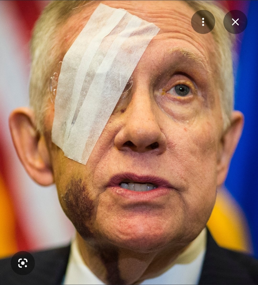 ehplam's tweet photo. @runews Same thing happened to Harry Reid 10 years ago. Same family? https://t.co/HOuaLRoIyf